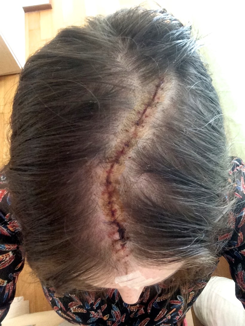 Dirty hair recovery shot! 